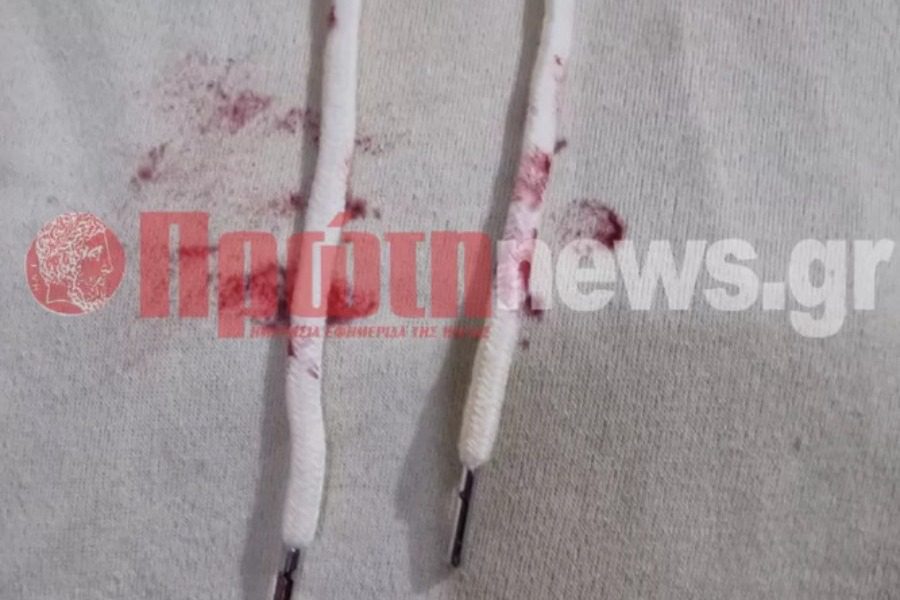 Νέο σοκ στην Ηλεία: Στο χειρουργείο 13χρονη μετά από χτύπημα που δέχτηκε από τον ίδιο της τον πατέρα