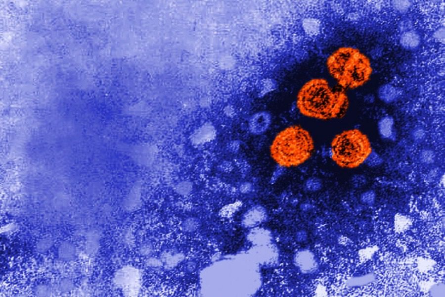 Μυστηριώδεις περιπτώσεις σοβαρής ηπατίτιδας σε μικρά παιδιά σε Ευρώπη και ΗΠΑ