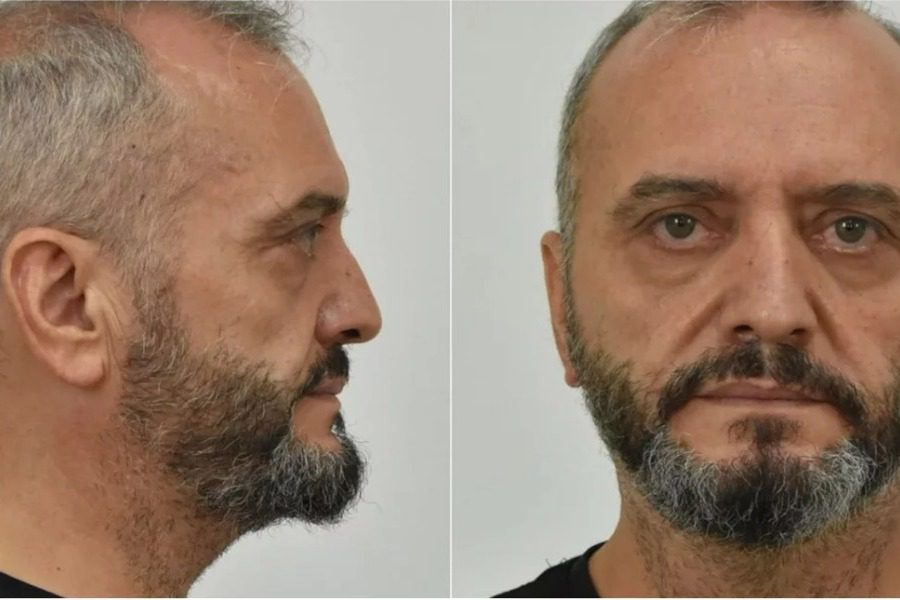 Κολωνός: «Ο Μίχος με πήγαινε στον οίκο ανοχής» 