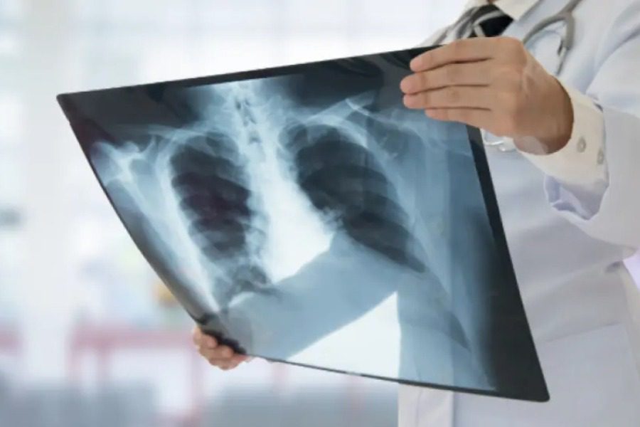 Τήνος: Τον έστειλαν για ακτινογραφία στο… κτηνιατρείο