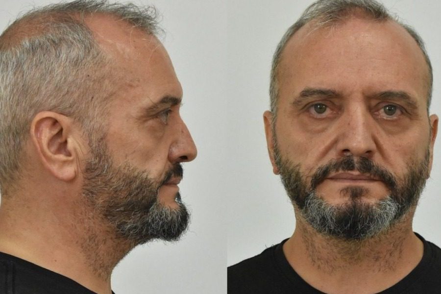 Σεπόλια: Οι κατηγορίες που αντιμετωπίζει ο 53χρονος