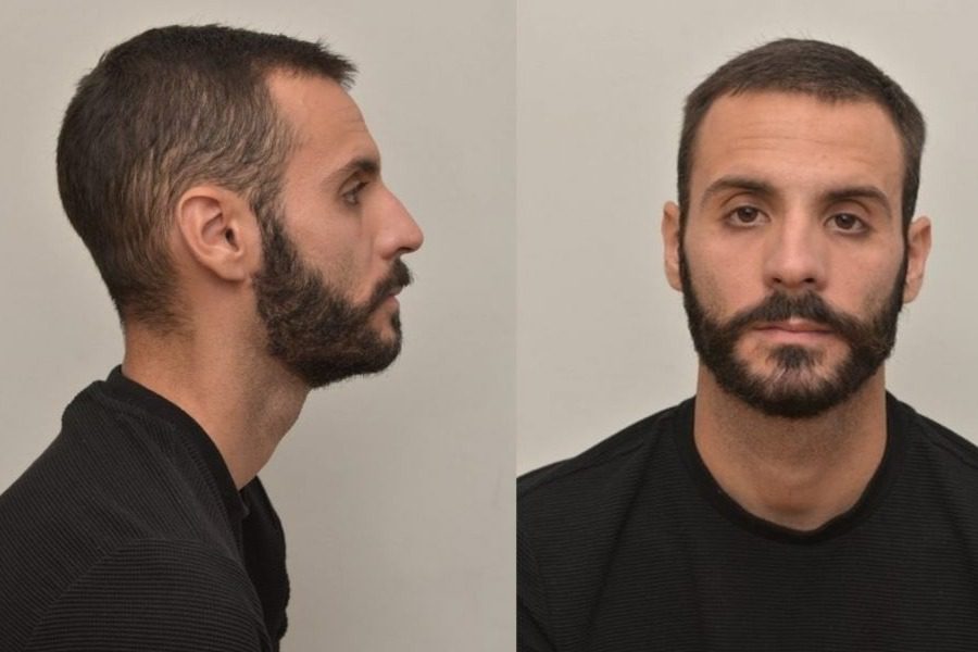 Αγρίνιο: Πού «κρύβεται» ο 28χρονος που κατηγορείται για ασέλγεια σε 4χρονο