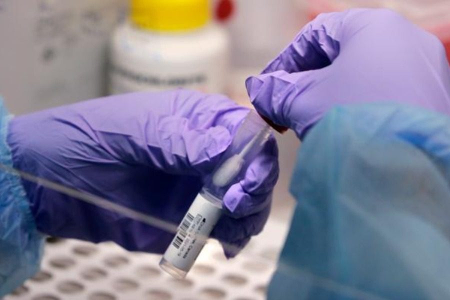 Κορωνοϊός: 3.195 νέα κρούσματα, 23 νεκροί, 204 διασωληνωμένοι