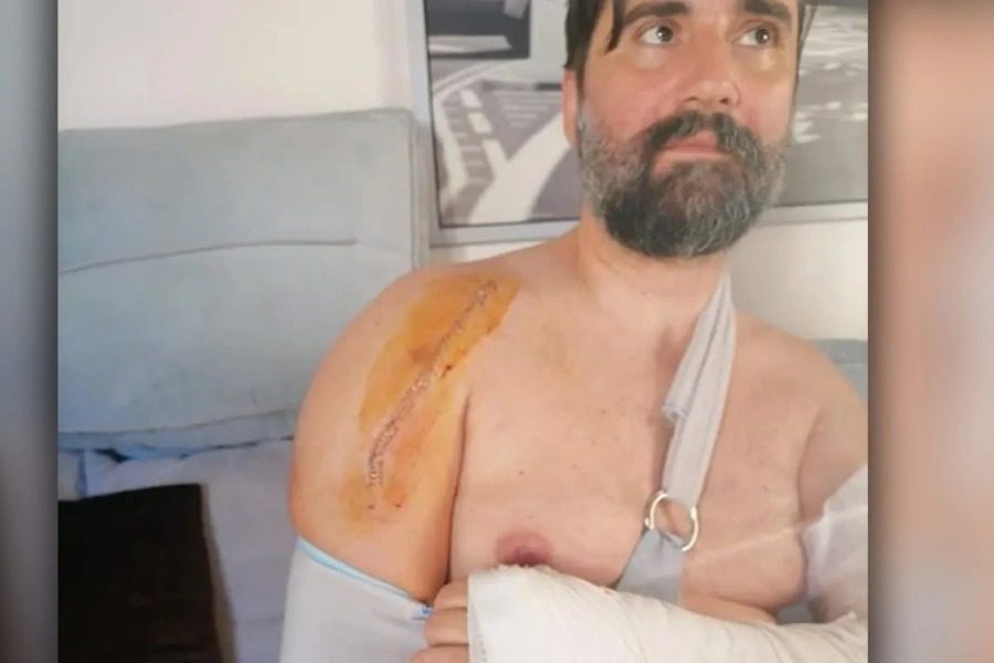 Διασώστης του ΕΚΑΒ «ανέβασε» φωτογραφίες από τον άγριο ξυλοδαρμό του στη Σαλαμίνα