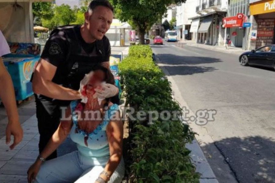 Λαμία: Τη γρονθοκοπούσε στο πρόσωπο μέσα στη μέση του δρόμου