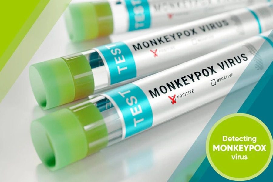 Παγώνη: Η νόσος της ευλογιάς των πιθήκων κρατάει τέσσερις εβδομάδες