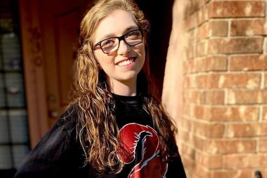 22χρονη δείχνει το πρόσωπό της μετά από τρομακτική επίθεση σκύλων