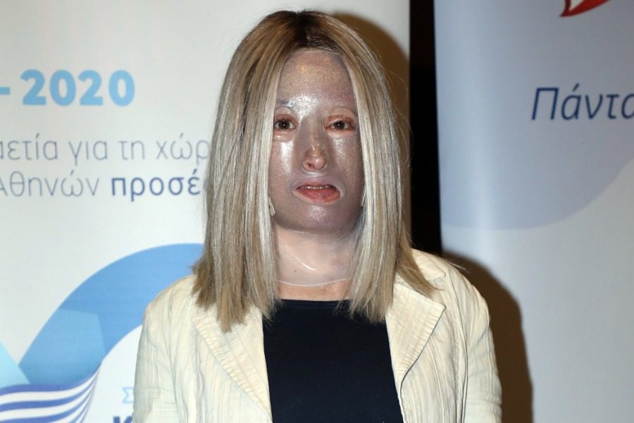 Ιωάννα Παλιοσπύρου: Η γιατρός της μιλά για τις επιπλοκές του τελευταίου χειρουργείου