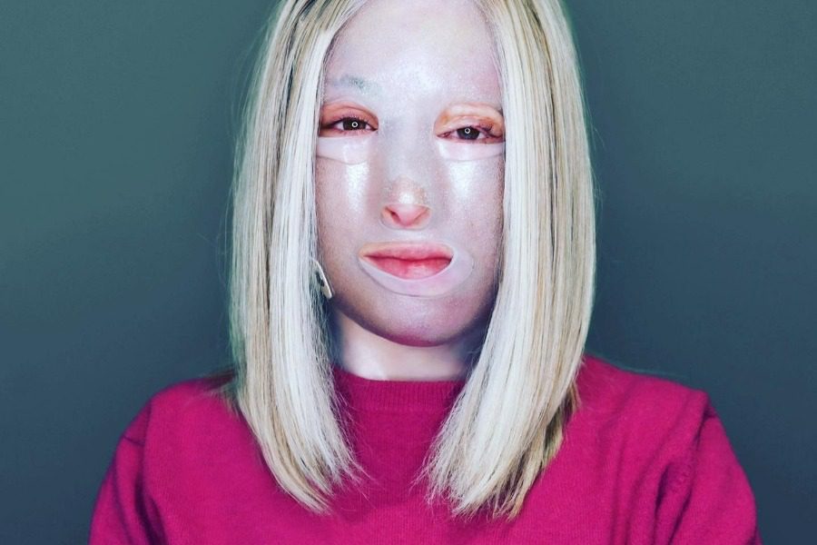 Ιωάννα Παλιοσπύρου: Η πρώτη φωτογραφία μετά το νέο της χειρουργείο