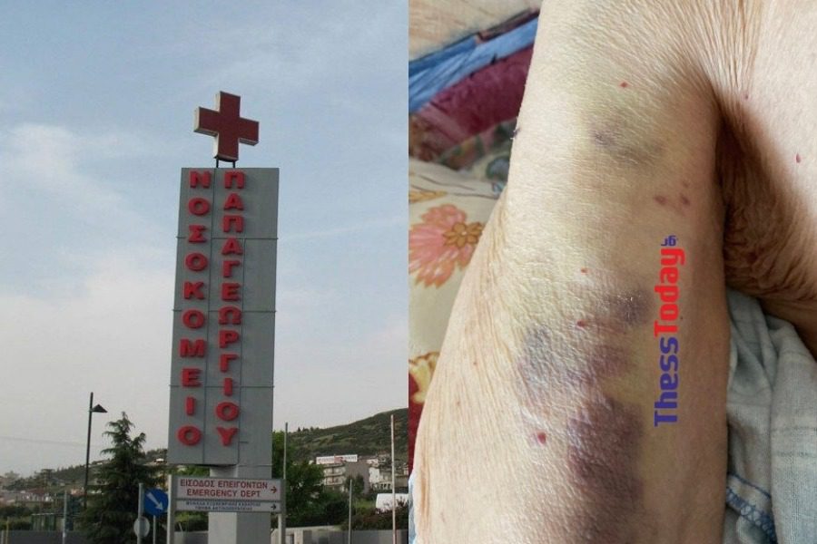 Θεσσαλονίκη: Καταγγελία δημοσιογράφου για κακοποίηση του πατέρα του στο Νοσοκομείο «Παπαγεωργίου»