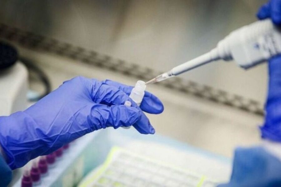 Πού εντοπίζονται τα 23.335 νέα κρούσματα