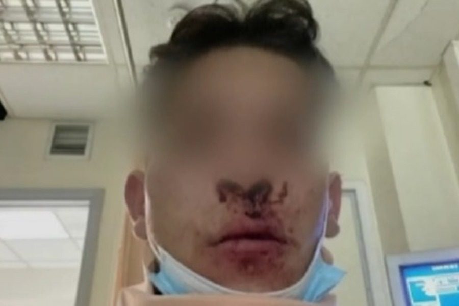 Θεσσαλονίκη: Βίντεο ντοκουμέντο από ενέδρα σε ζευγάρι