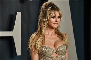 Heidi Klum: Το αποκαλυπτικό ατύχημα στο Instagram