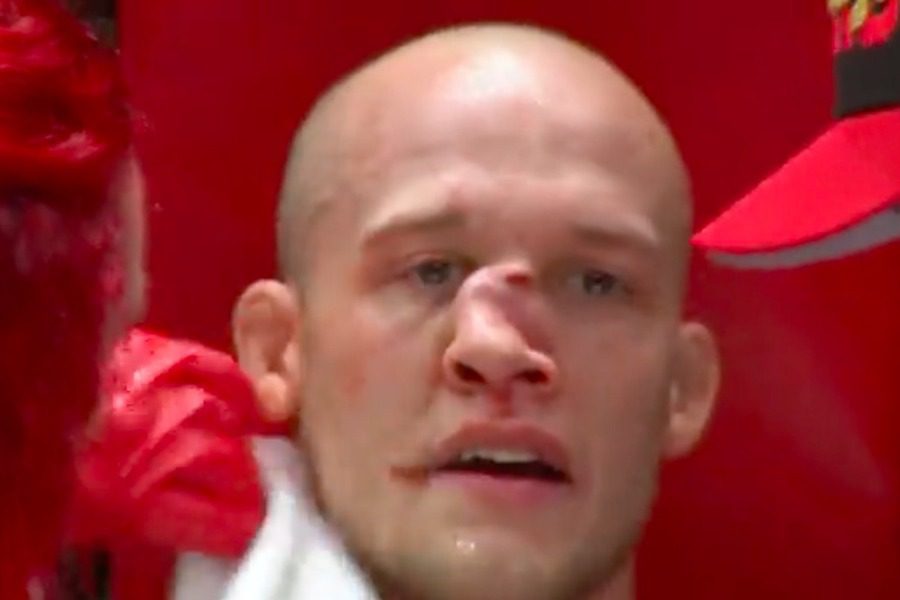 MMA: Του διέλυσε τη μύτη με μία γονατιά