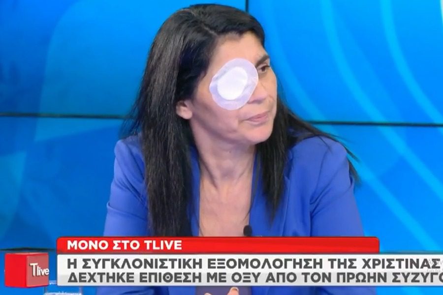 «Ούρλιαζα, καιγόμουν» περιγράφει η 49χρονη που δέχθηκε επίθεση με οξύ από τον πρώην σύζυγό της