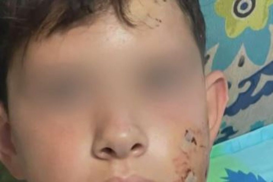 Λαγονήσι: Σκύλος κατασπάραξε αγοράκι την ώρα που πήγαινε στο σχολείο