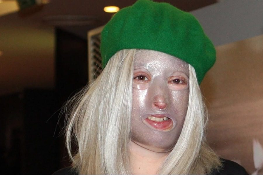 Ιωάννα Παλιοσπύρου: Παρουσίασε επιπλοκή και μπαίνει για το 11ο χειρουργείο