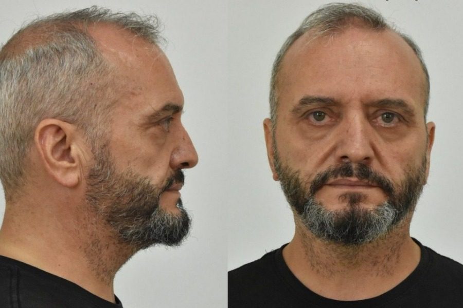 Χυδαιότητα από τον πατέρα του Μίχου για τη 12χρονη: «Αμα του κουνιόταν κάτι θα έκανε»