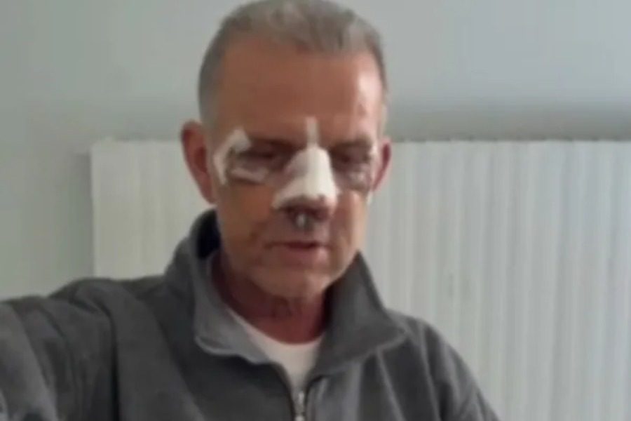 Περιστέρι: Του ζήτησε να μετακινήσει λίγο το αυτοκίνητό του κι εκείνος τον ξυλοκόπησε