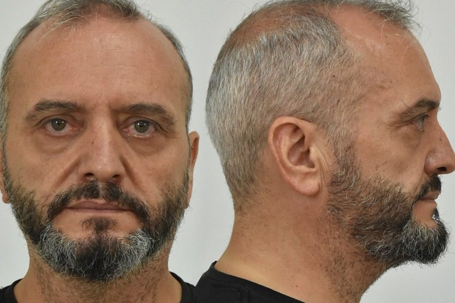 Βιασμός 12χρονης: Τι λένε πρώην σύζυγος και γιος του Ηλία Μίχου