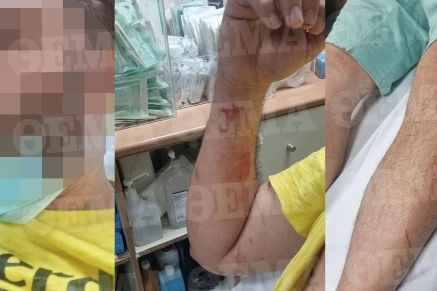 Ανω Λιόσια: Στο νοσοκομείο για μία ...παρατήρηση