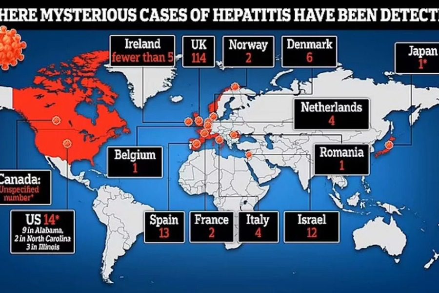 Οξεία ηπατίτιδα στα παιδιά: Σε συναγερμό η ΕΕ