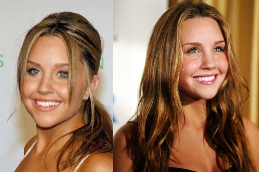 Amanda Bynes: Το αστέρι των 00s «βυθίστηκε» στο σκοτάδι, αλλά μοιάζει ακόμα 18 χρονών