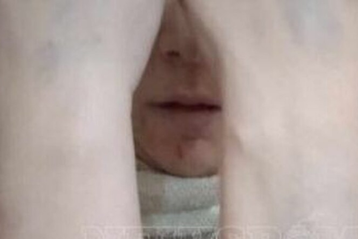 Αργος: Ξεσπά η γυναίκα που τη «σιδέρωσε» ο σύζυγός της ‑ «Να σαπίσει στη φυλακή το τέρας»