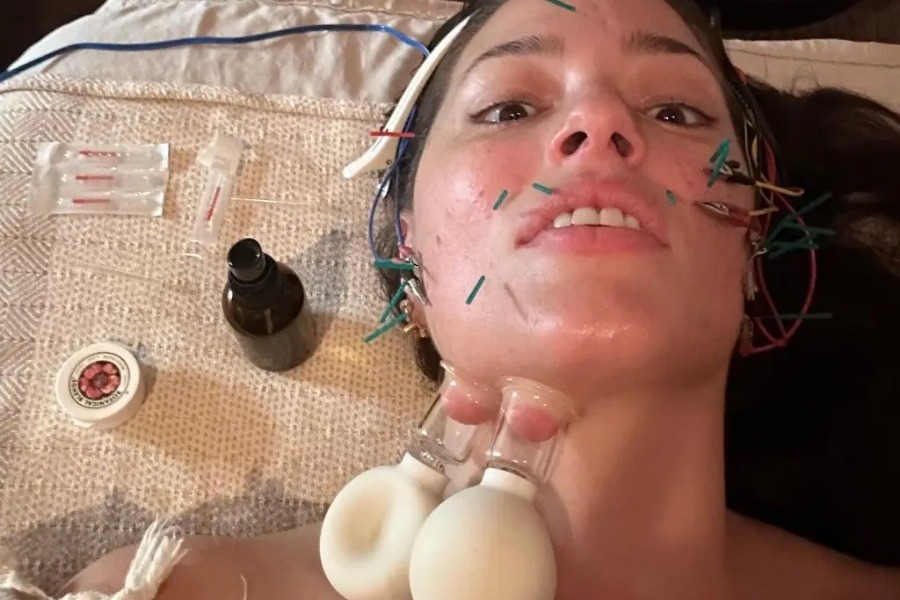 Tι έπαθε η Ashley Graham; Η φωτογραφία που έκανε τους φαν να τρομάξουν