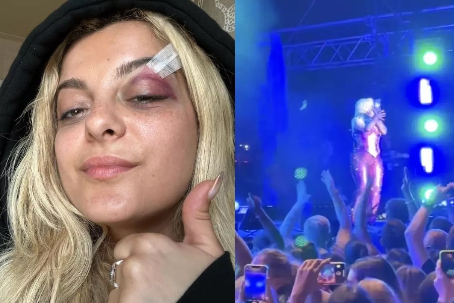 Πέταξαν κινητό στο πρόσωπο της Bebe Rexha: Eπεσε κάτω από τους πόνους