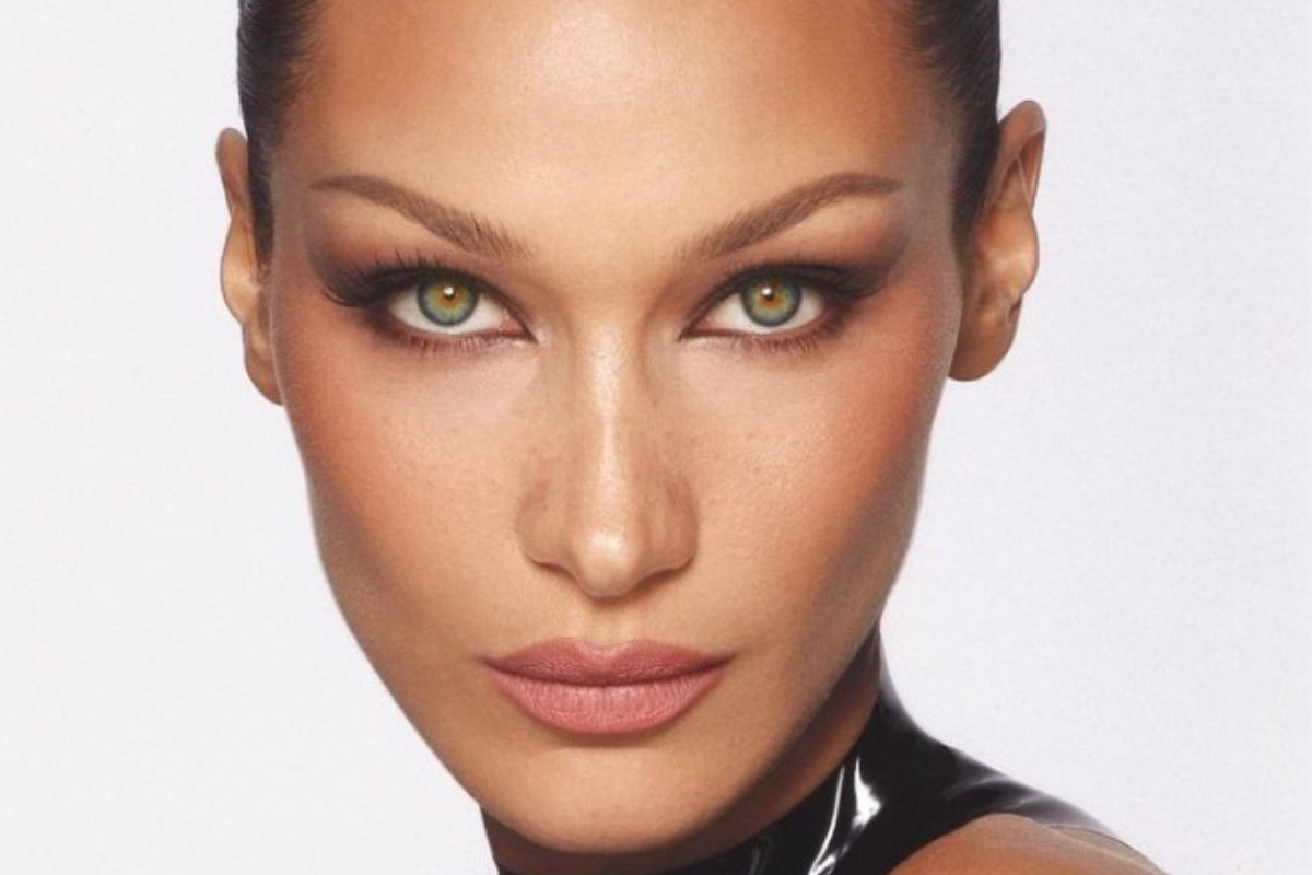 Πέντε celebrities που μετάνιωσαν για τις πλαστικές τους επεμβάσεις