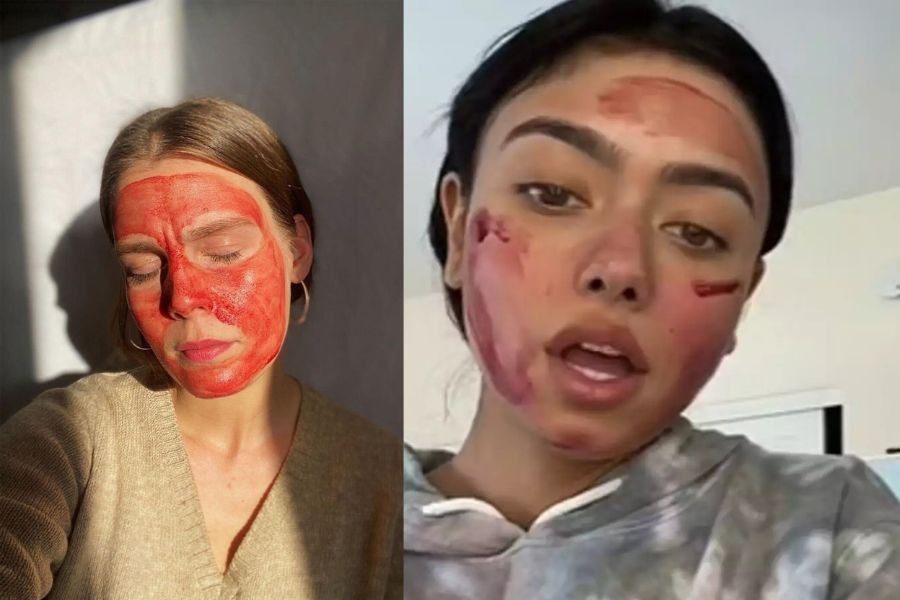 Το πιο εξωφρενικό beauty trend που έχουμε ακούσει ποτέ. Θα το έκανες;