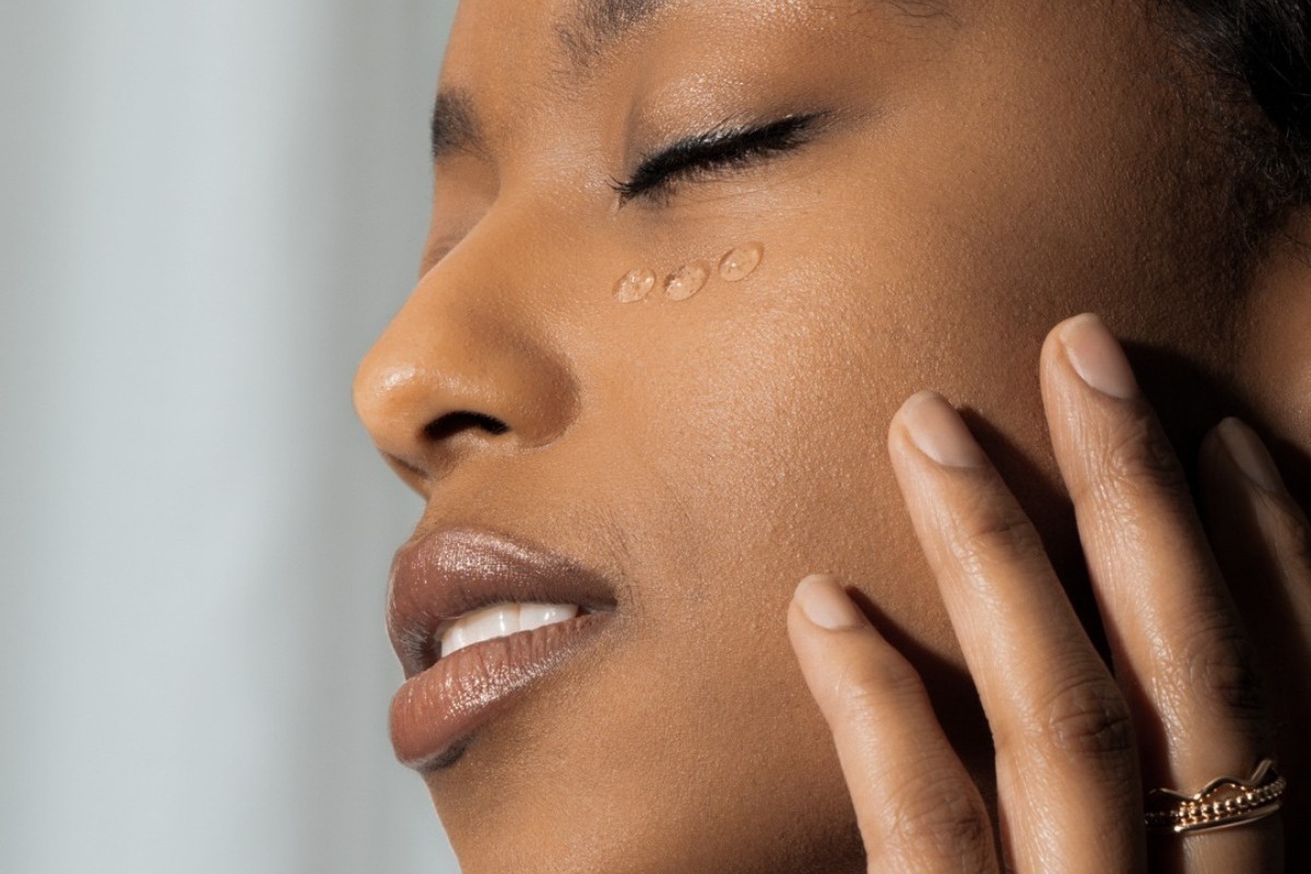 Μαύροι κύκλοι: Οι δύο τρoφές που θα σε βοηθήσουν να τους βελτιώσεις