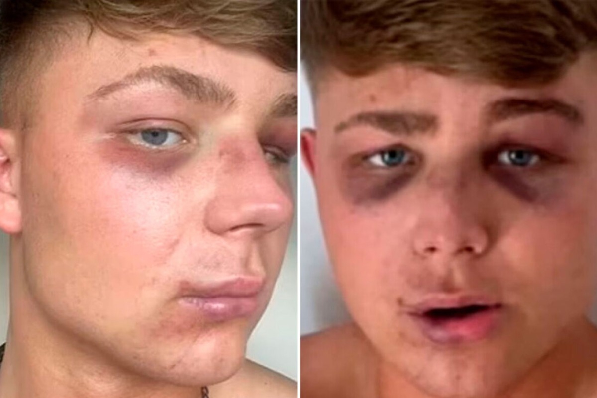 Ζάκυνθος: «Με έστειλαν στο νοσοκομείο για μία selfie»