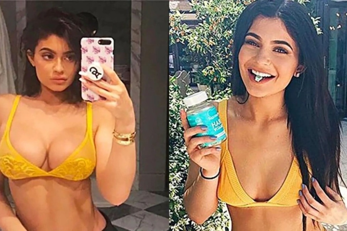 Η Kylie Jenner παραδέχτηκε την αυξητική στήθους ‑ «Το μετάνιωσα. Δε θα άγγιζα τίποτα»