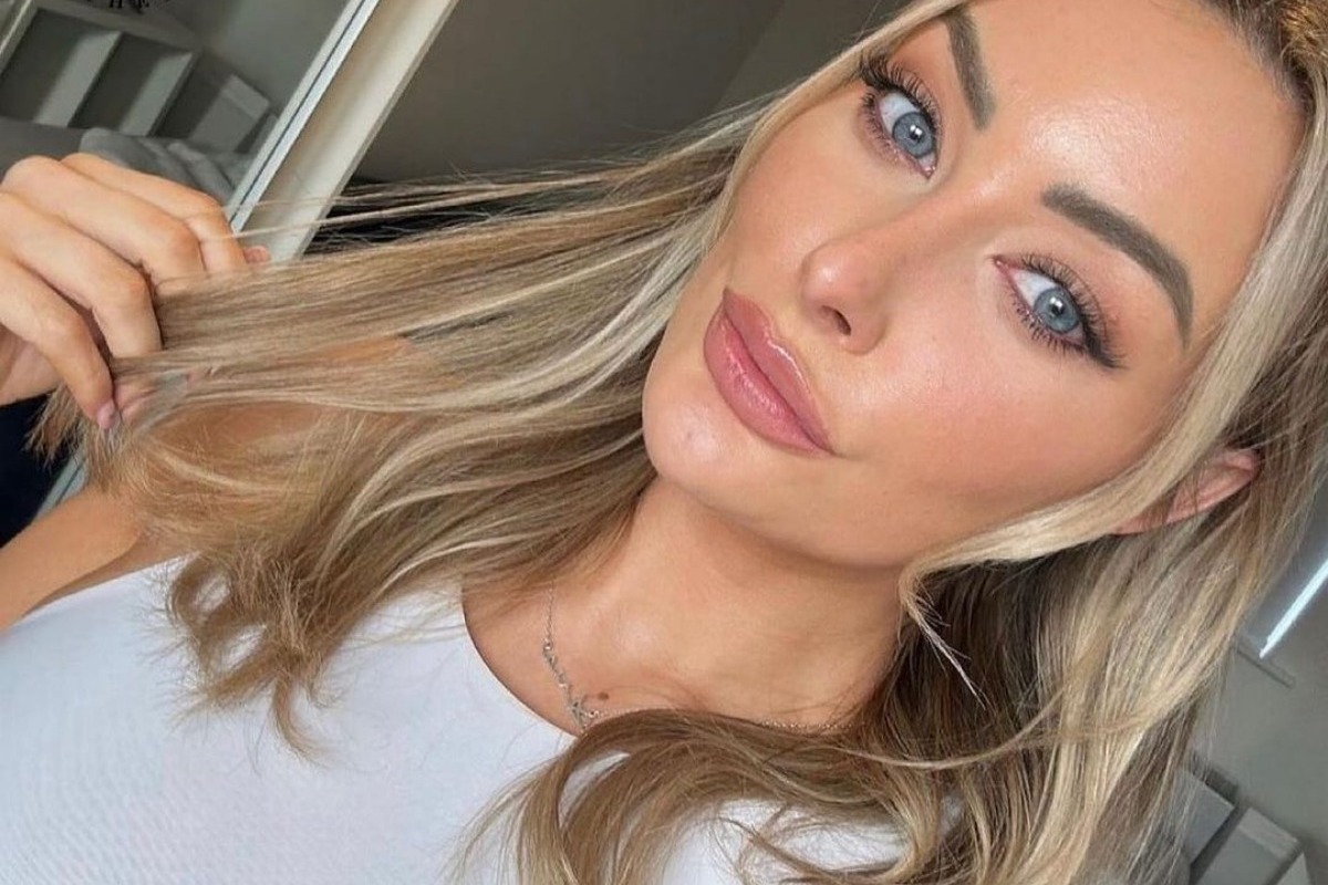 Ο κίνδυνος που αντιμετωπίζουν συχνά όσες βάζουν fillers στα χείλη