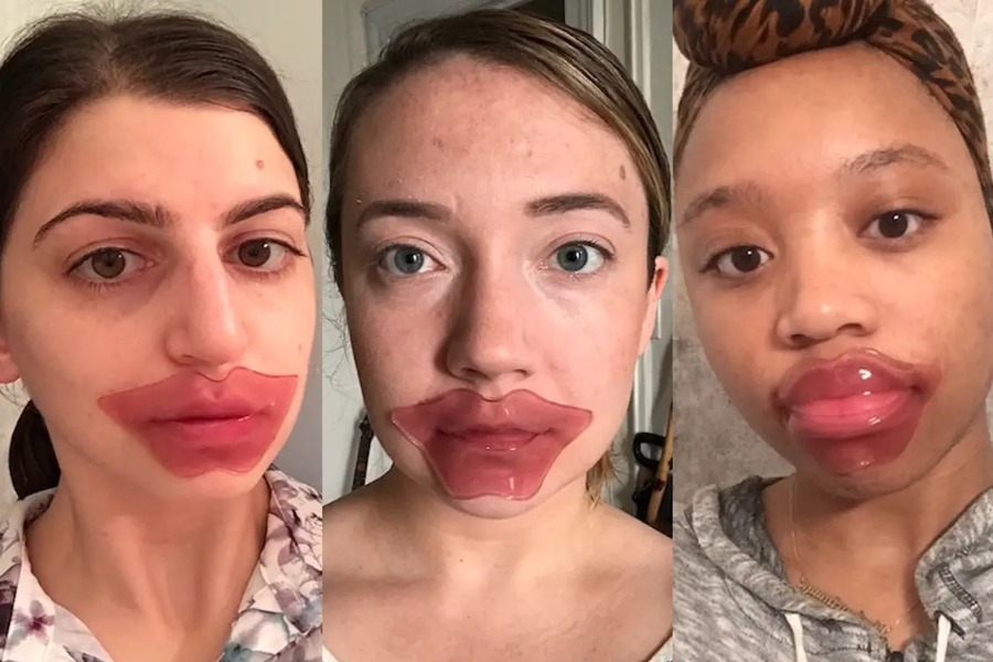 Είναι μεγάλη μόδα αλλά... λειτουργούν πραγματικά οι μάσκες για τα χείλη;