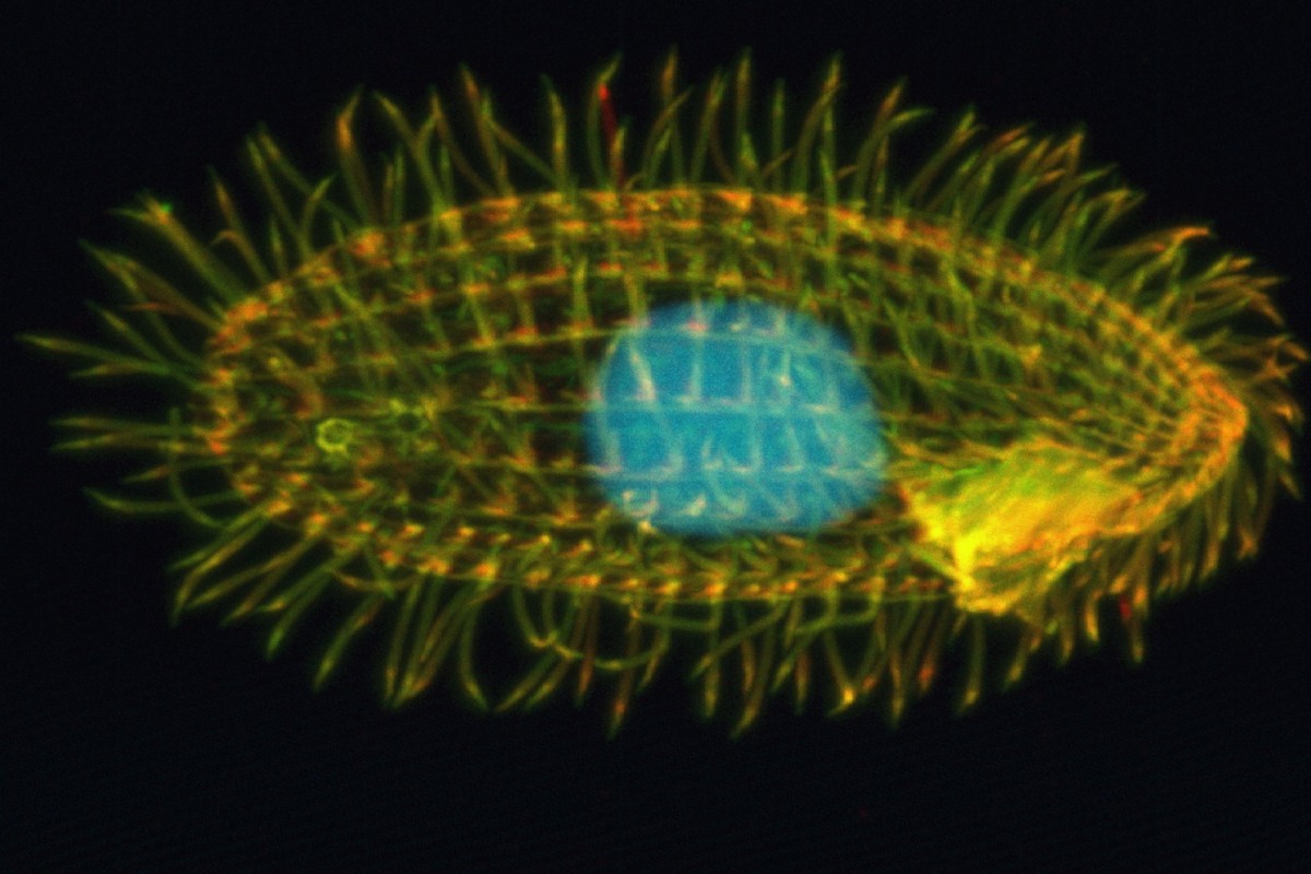 Το μικρόβιο που μπορεί να επιλέξει ανάμεσα από επτά σeξουαλικά φύλα