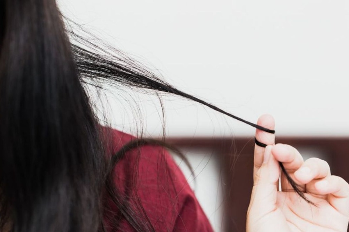 Θεσσαλονίκη: Ανήλικη είχε στο στομάχι της μία γιγαντιαία μάζα τρίχες