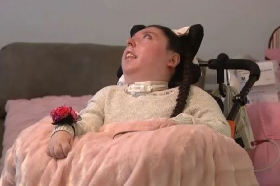 ΗΠΑ: Γυναίκα που γεννήθηκε χωρίς εγκέφαλο έκλεισε τα 20 ‑ Οι γιατροί της έδιναν 4 χρόνια ζωής