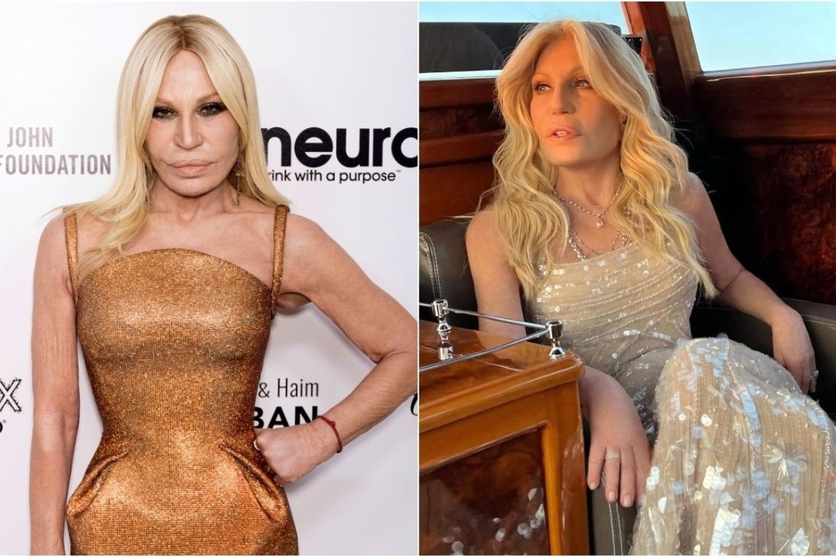 Donatella Versace: Τεράστια αλλαγή ‑ Σοκάρουν οι φωτογραφίες μετά τις νέες πλαστικές