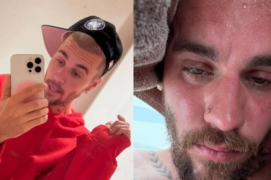 Justin Bieber: Αποκάλυψε ότι βρίσκεται σε περίοδο αποτοξίνωσης