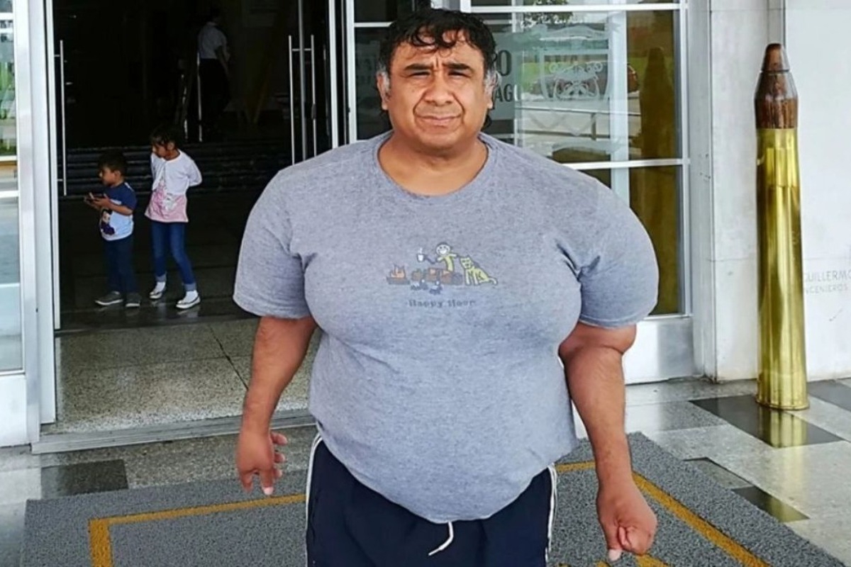 Περού: Δύτης έχει «φυσαλίδες αζώτου» στο σώμα εδώ και 11 χρόνια – «Ζω σαν φουσκωμένο μπαλόνι»