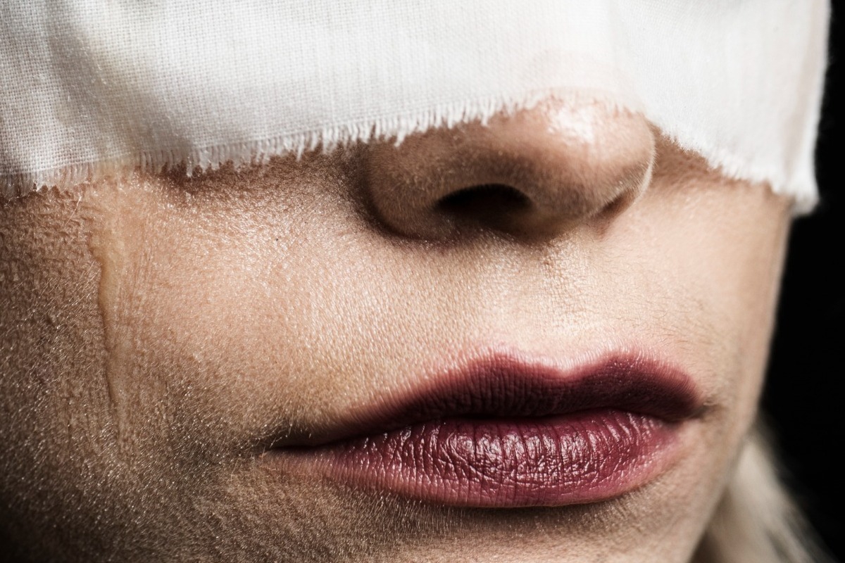 Θεσσαλονίκη: Εξαρθρώθηκε κύκλωμα trafficking ‑ Παγίδευαν γυναίκες από τη Λατινική Αμερική