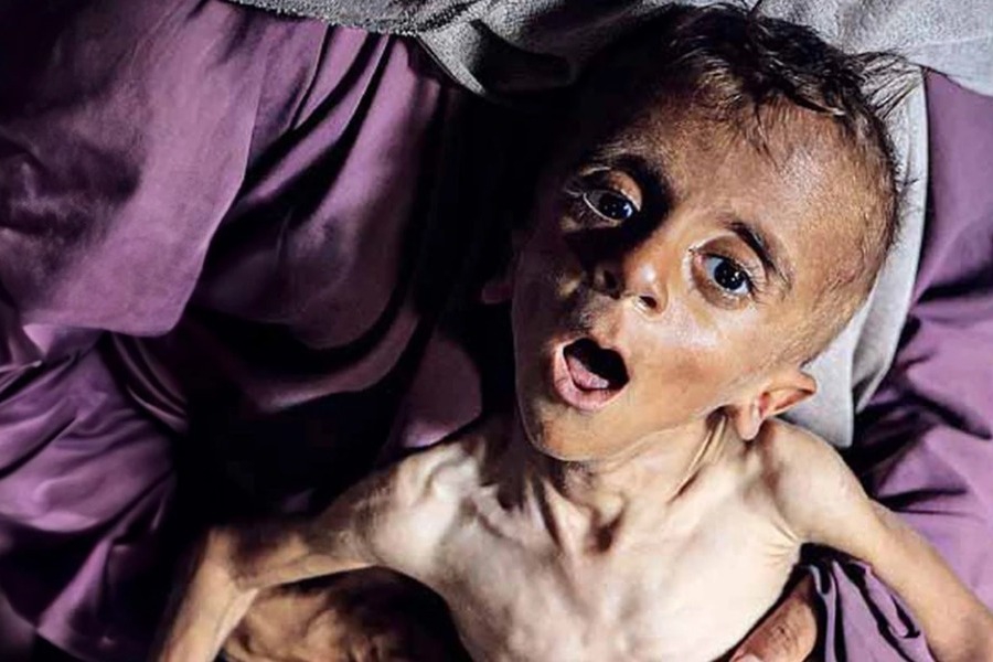 Το συγκλονιστικό εξώφυλλο της Daily Express με σκελετωμένο μωρό στη Γάζα