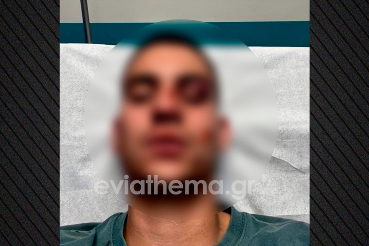 Χαλκίδα: 18χρονος έστειλε στο νοσοκομείο με κάταγμα 19χρονο επειδή έκανε like στη σύντροφό του