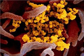 Έκτακτη προειδοποίηση του Παγκόσμιου Οργανισμού Υγείας - Το νέο στέλεχος H3N2 προκαλεί φόβο