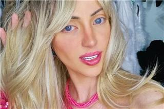 Πέθανε η «ανθρώπινη Barbie» – Το μυστήριο και τα αναπάντητα ερωτήματα γύρω από τον θάνατο της