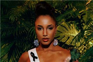 Μις Υφήλιος: Στην εντατική η Μις Τζαμάικα μετά την πτώση της από τη σκηνή - Δεν τα πάει καλά