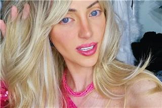 Ξανά στο προσκήνιο ο θάνατος της «Ανθρώπινης Barbie»: Η οικογένεια μιλά για δολοφονία μετά την ιατροδικαστική εξέταση